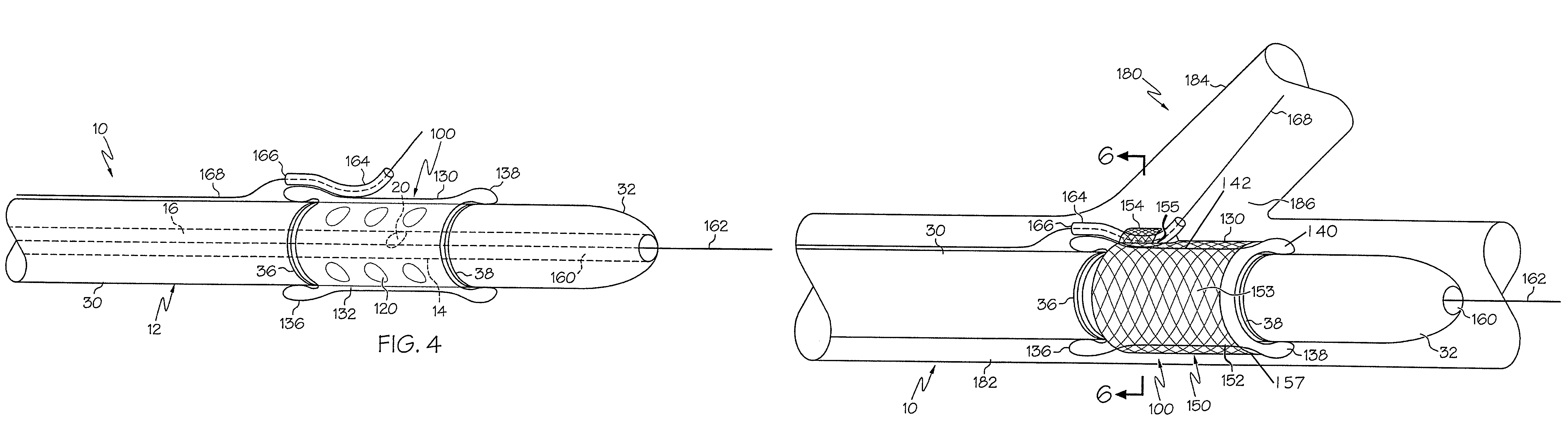 Rotating stent delivery system for side branch access and protection and method of using same