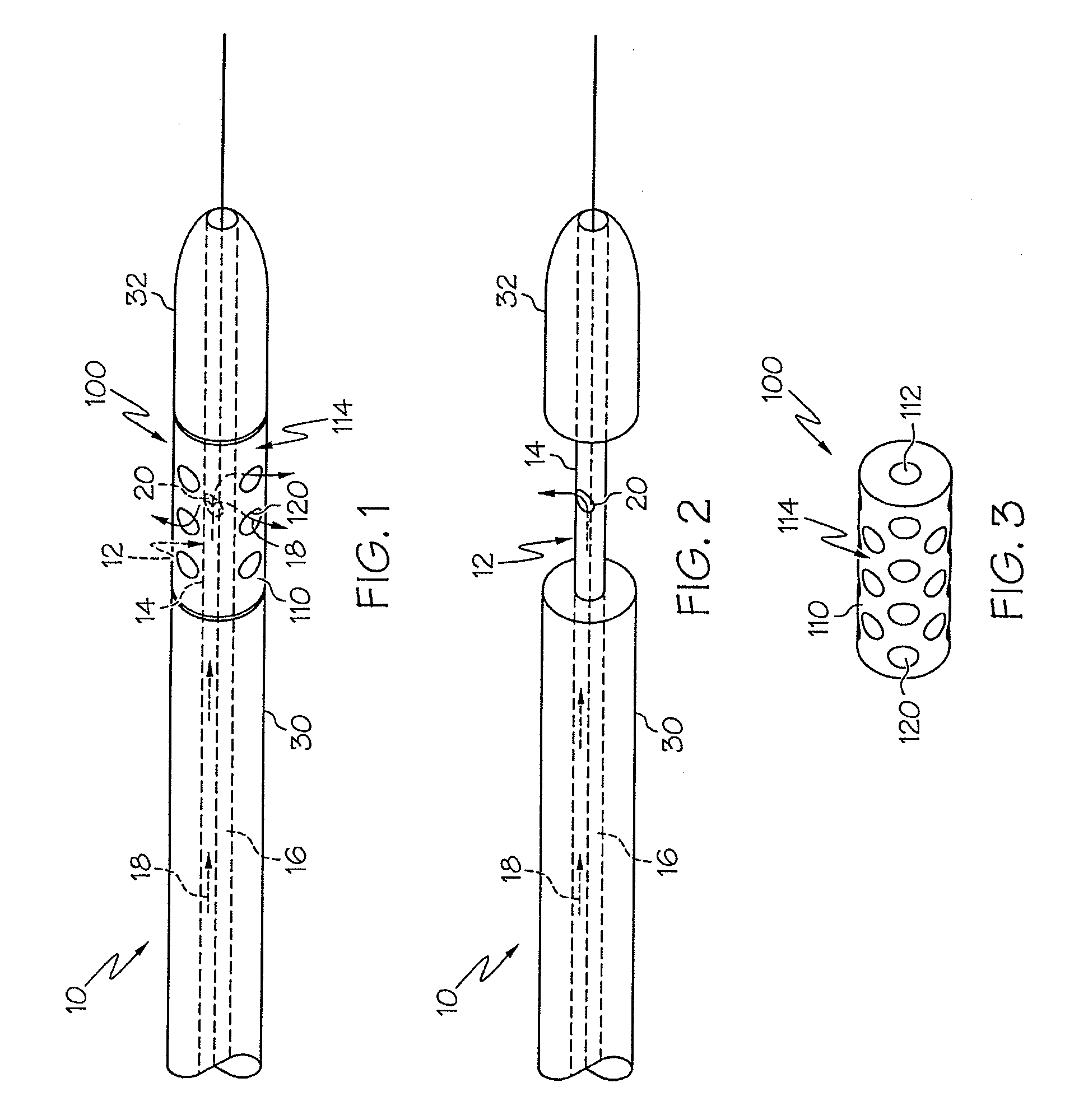 Rotating stent delivery system for side branch access and protection and method of using same