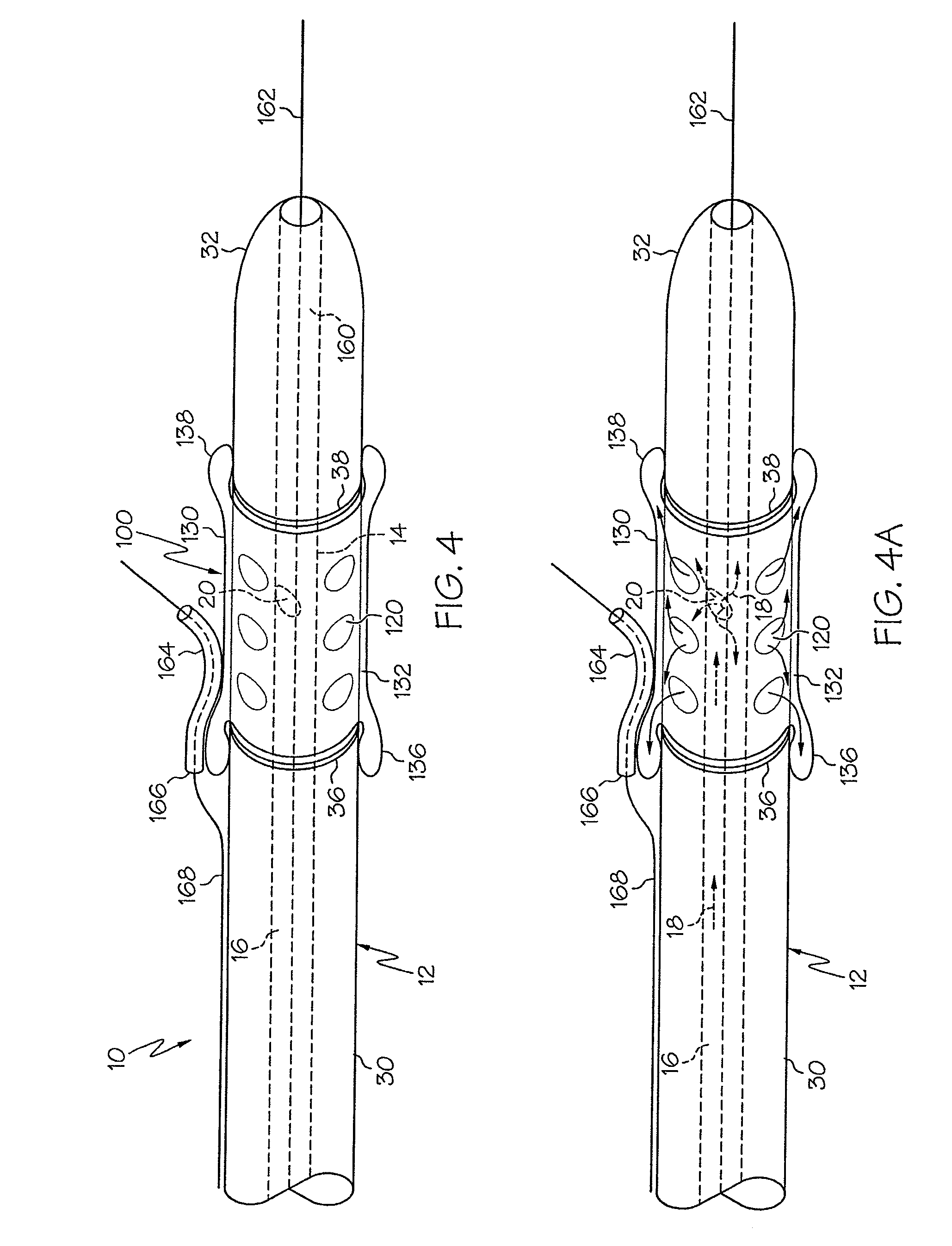 Rotating stent delivery system for side branch access and protection and method of using same