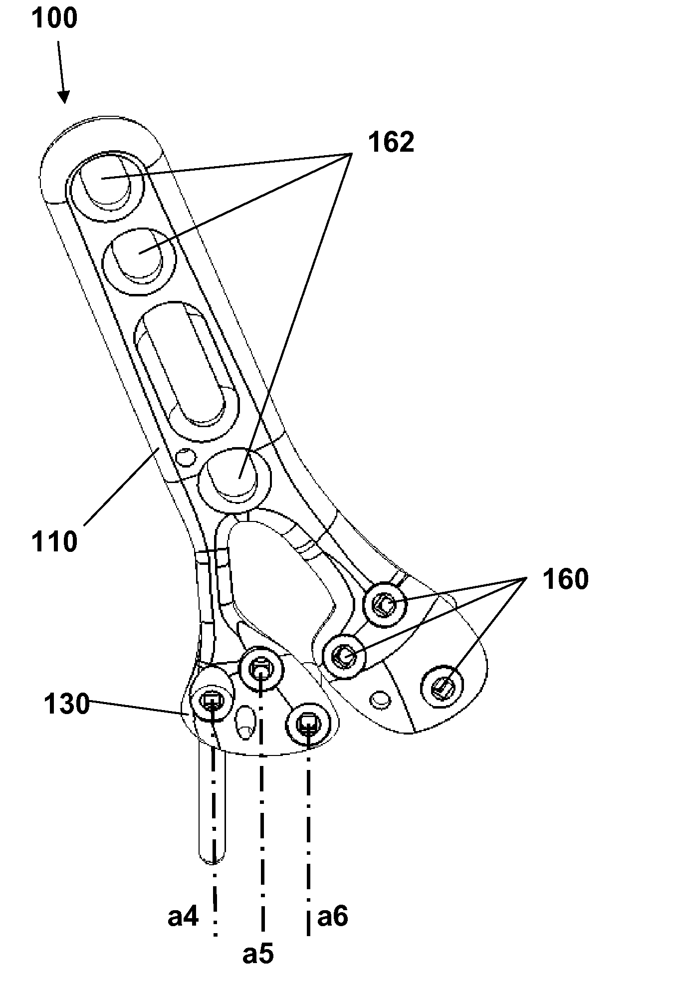 Fracture fixation plate, system and methods of use