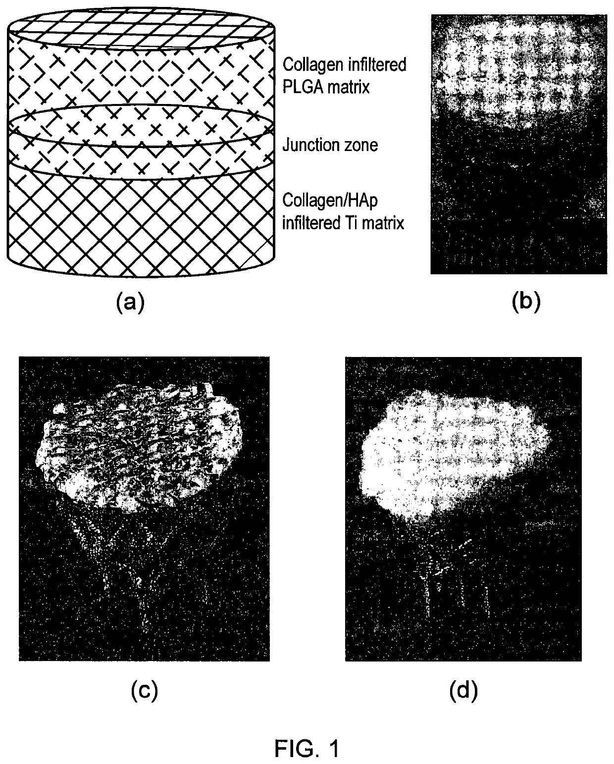 Osteochondral scaffold