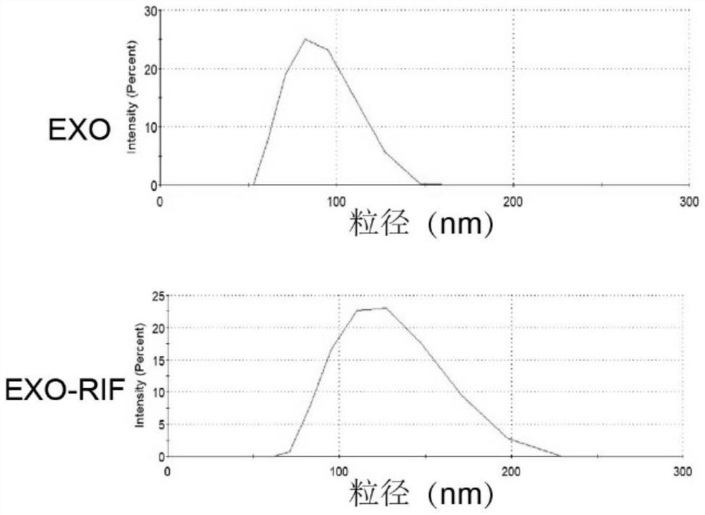 Exosome compound with tumor inhibition effect