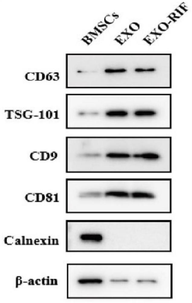 Exosome compound with tumor inhibition effect