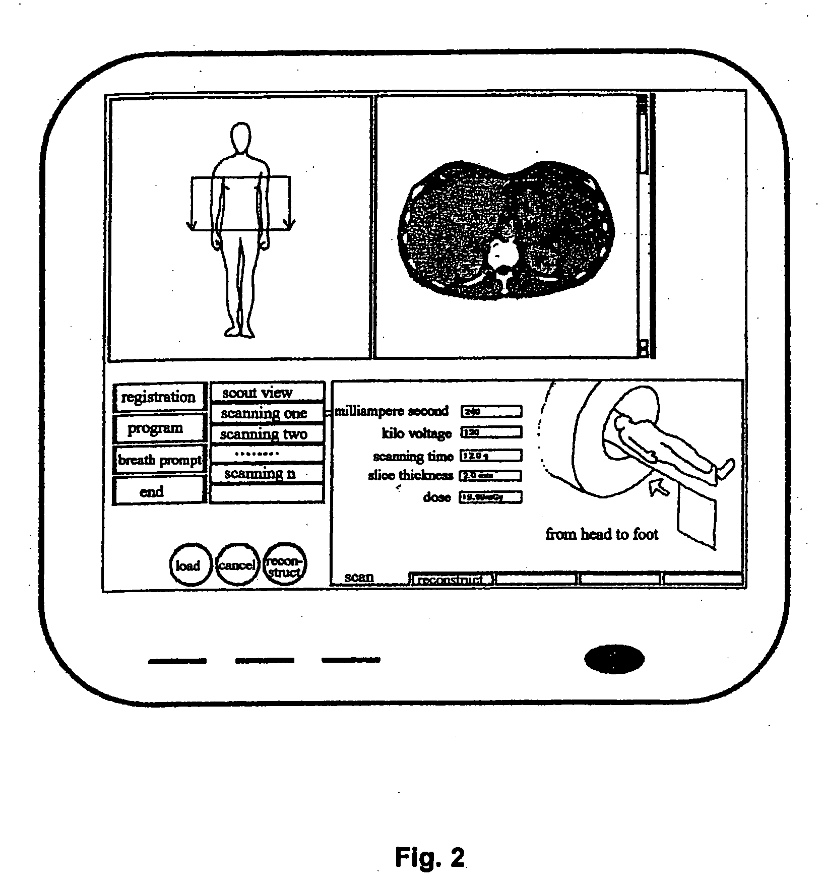 Operating method implemented through a user interface for a computed tomography examination