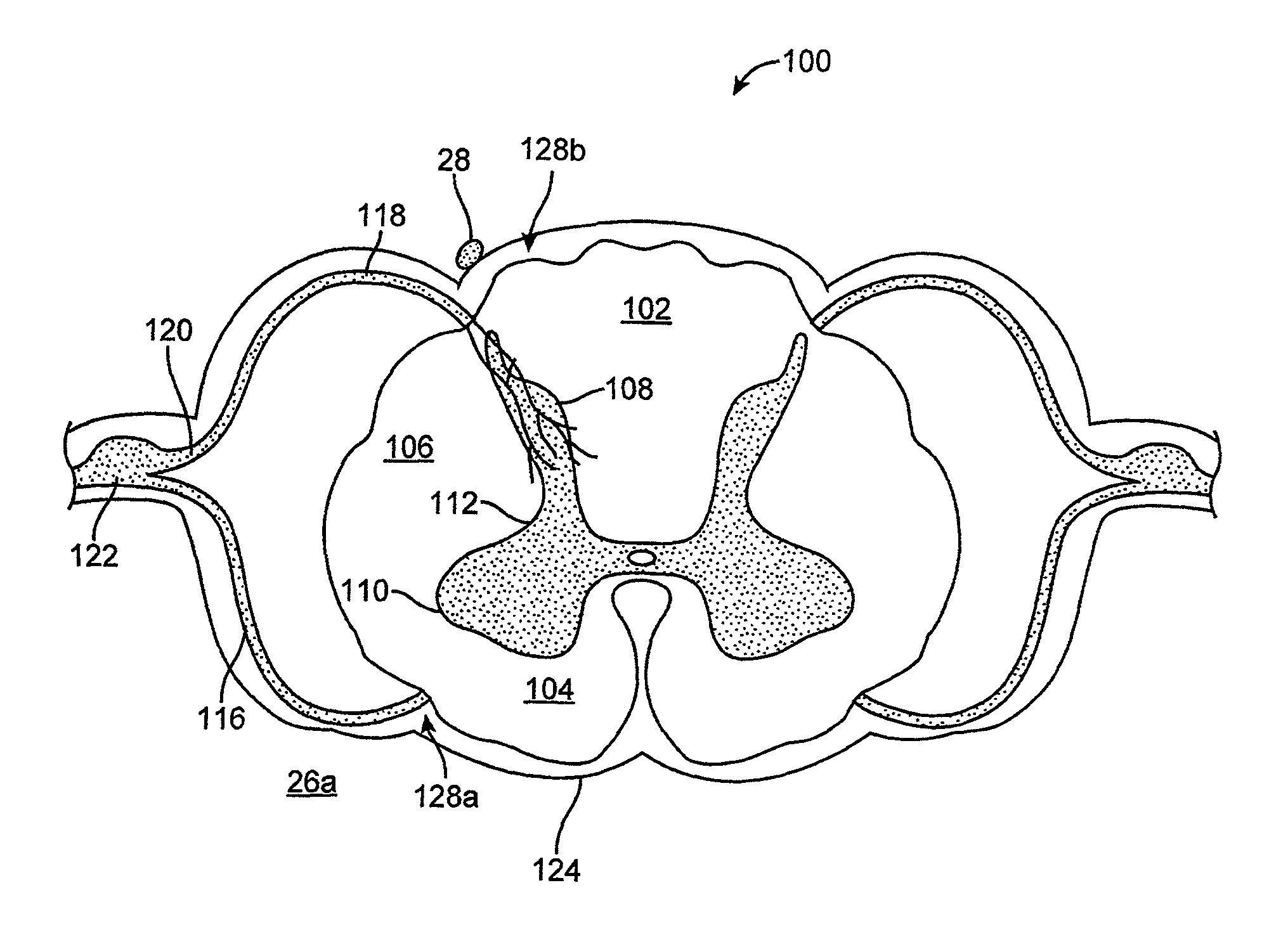 Method for selectively modulating neural elements in the dorsal horn