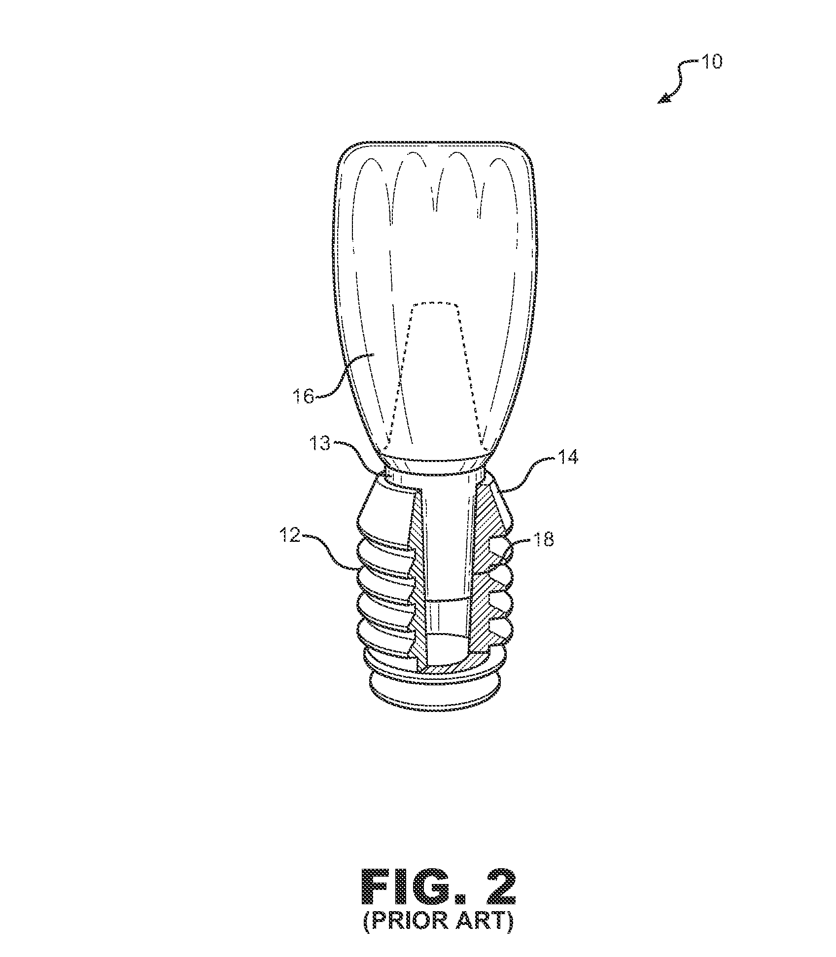 Dental implant system and method of use