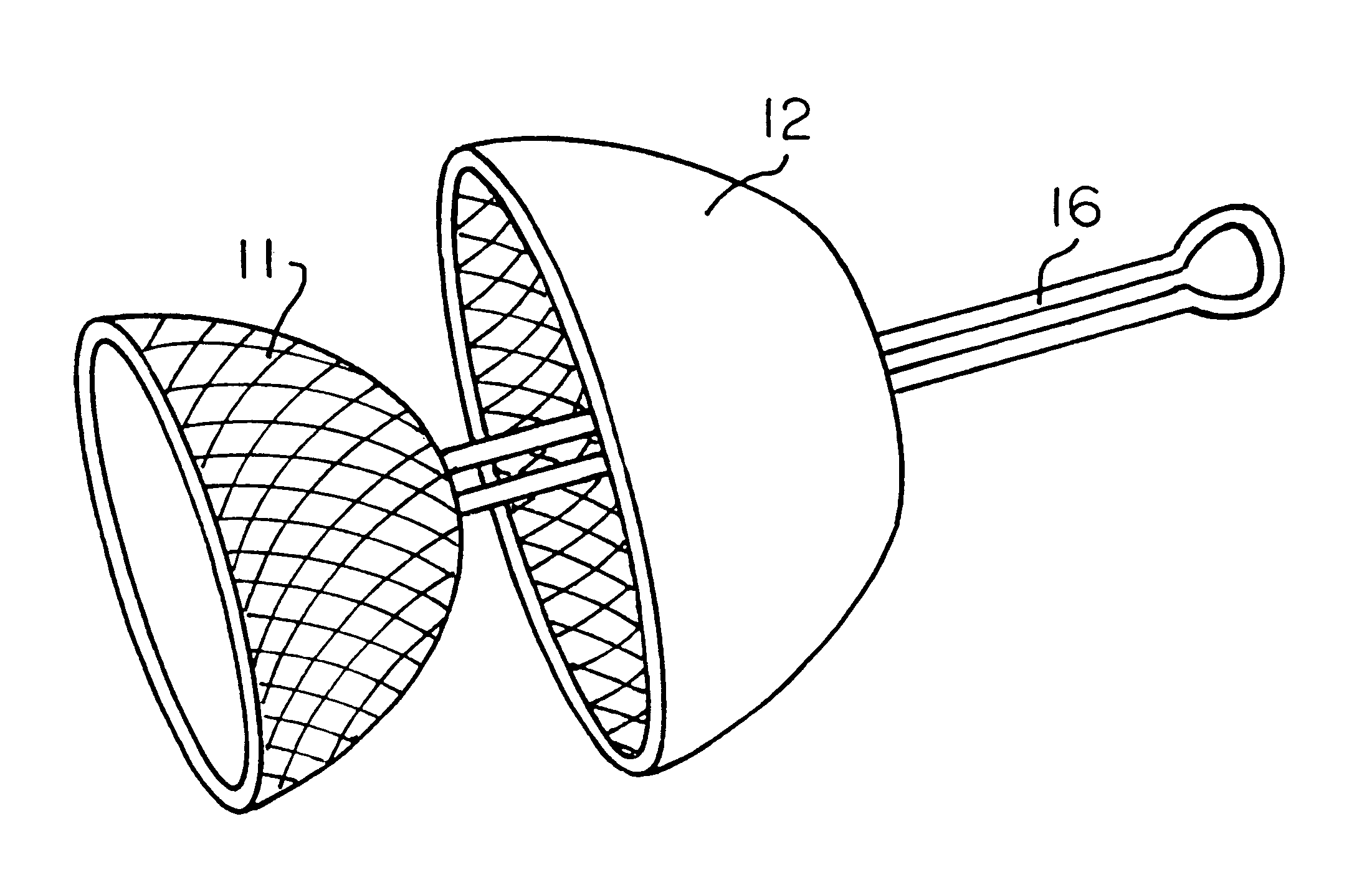 Foreskin restoration device