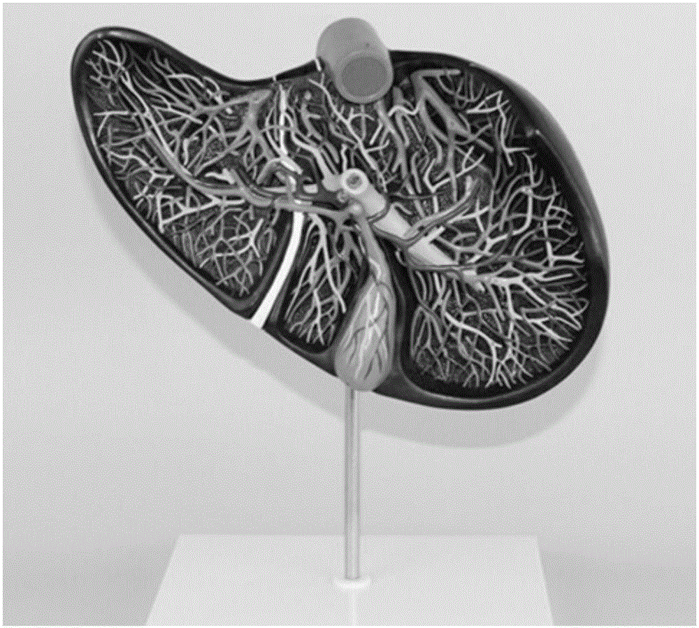 Method for printing liver cancer model by three-dimensional (3D) printing technology and liver cancer model