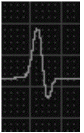 Electrocardiogram waveform classification method and device