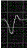 Electrocardiogram waveform classification method and device