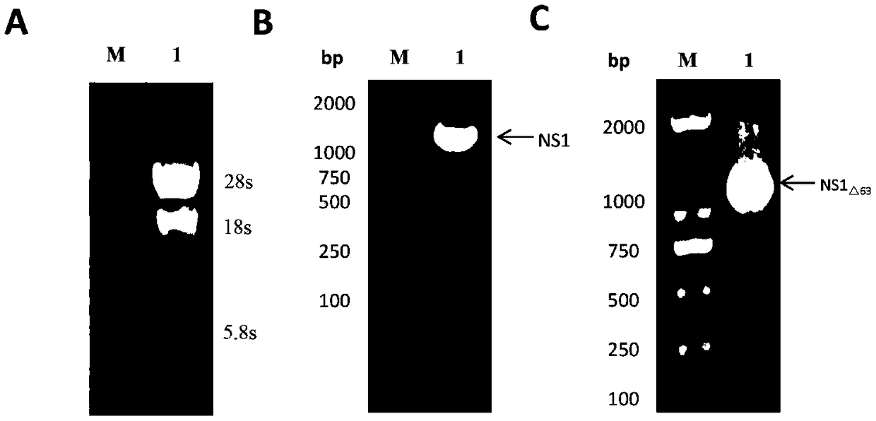 Encephalitis b virus non-structural protein NS1 truncated mutant as well as coding gene and application thereof