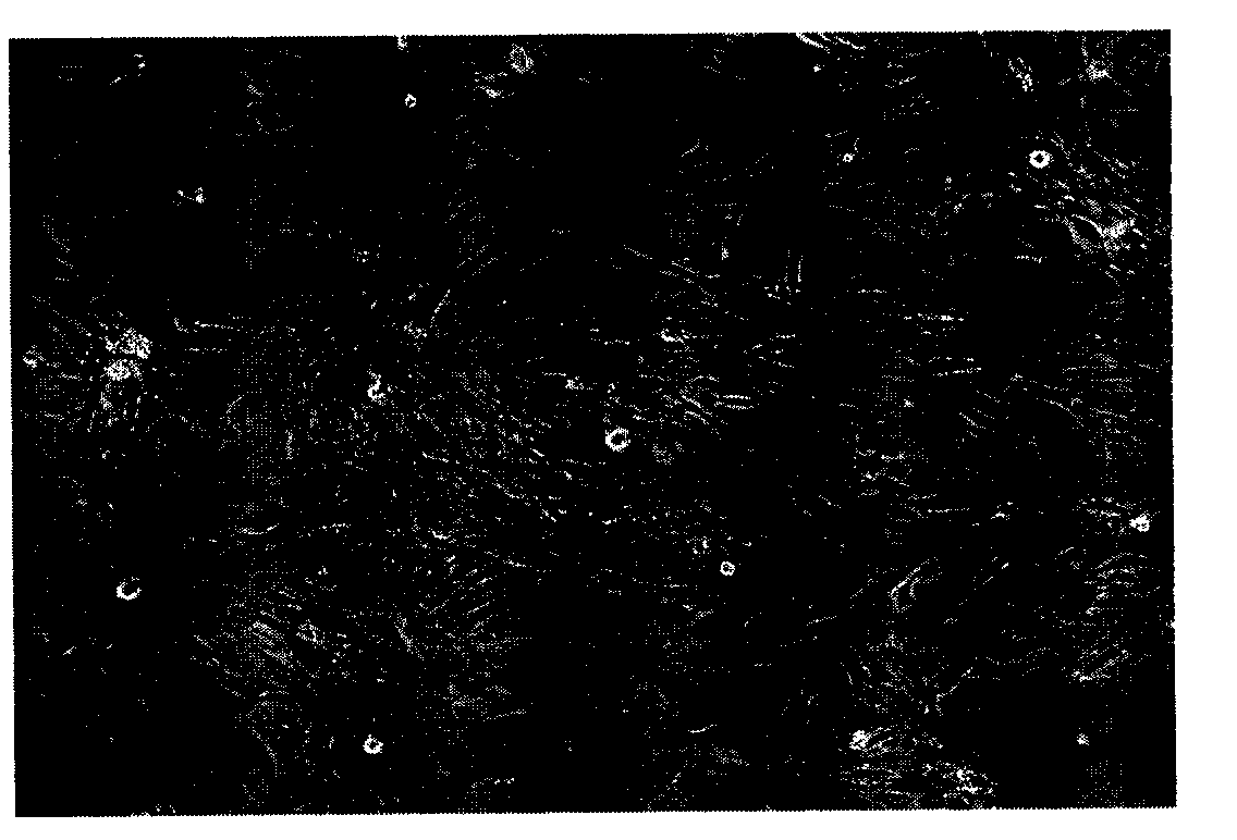 Human osteosarcoma cell strain and application thereof