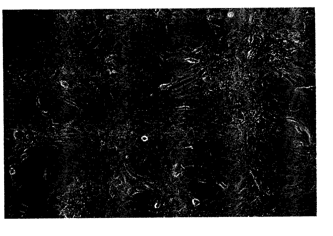 Human osteosarcoma cell strain and application thereof