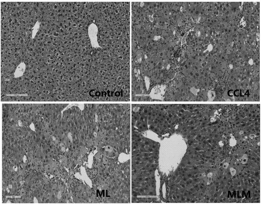 Novel application of massoia lactone and 5-hydroxy-2-caproleic acid