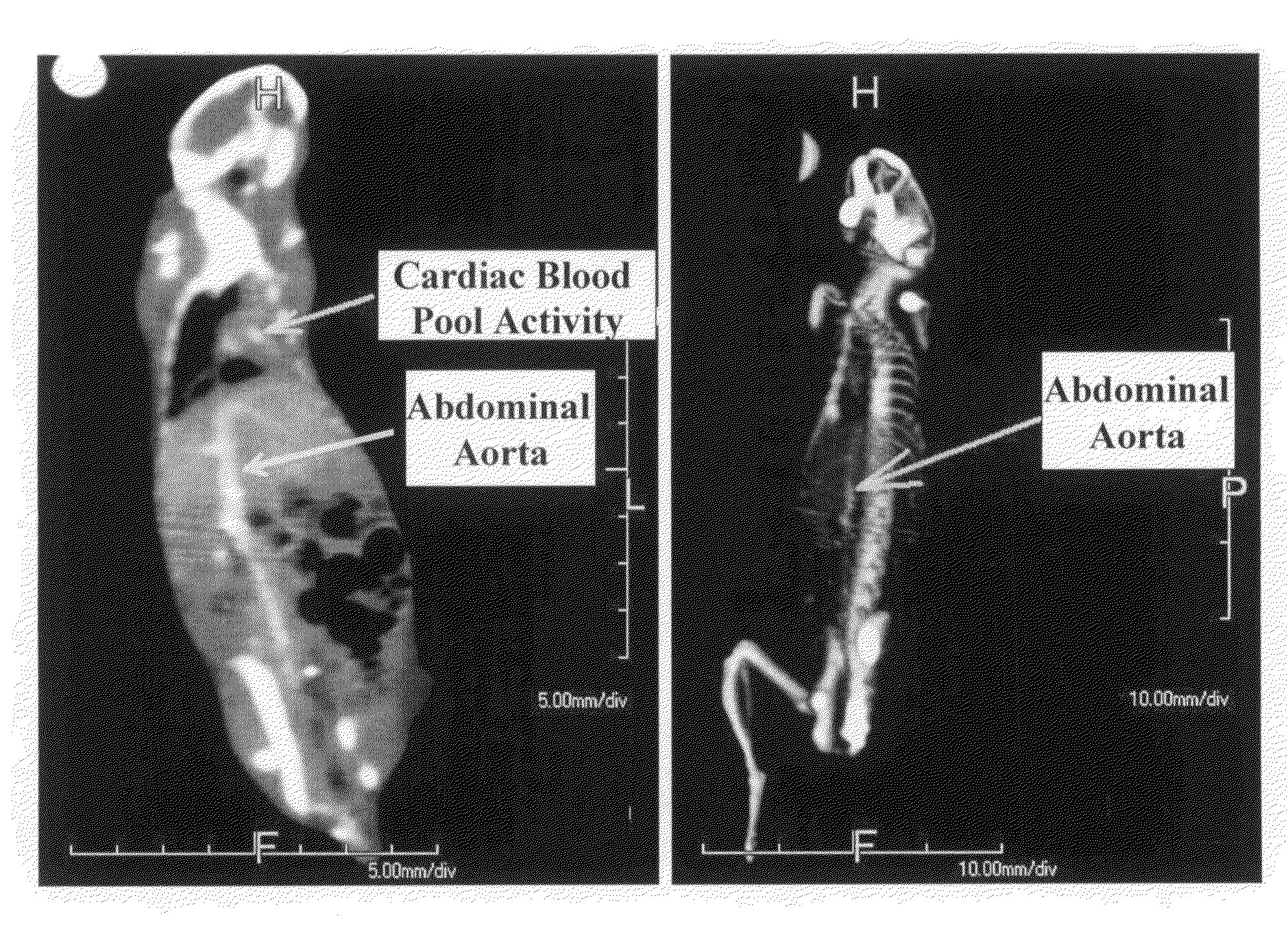 Gold nanoparticle imaging agents and uses thereof