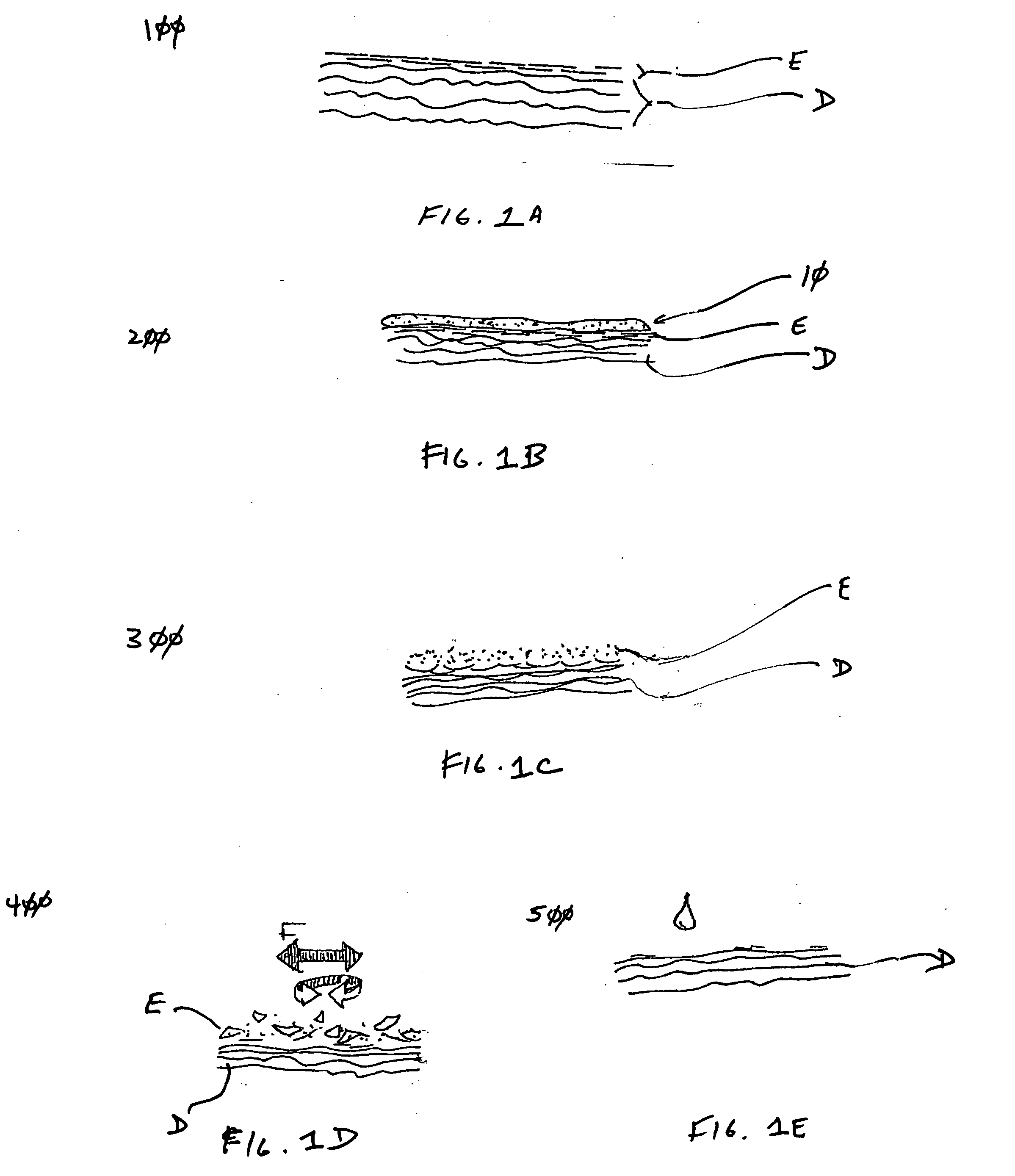 Dermabrasion composition and process