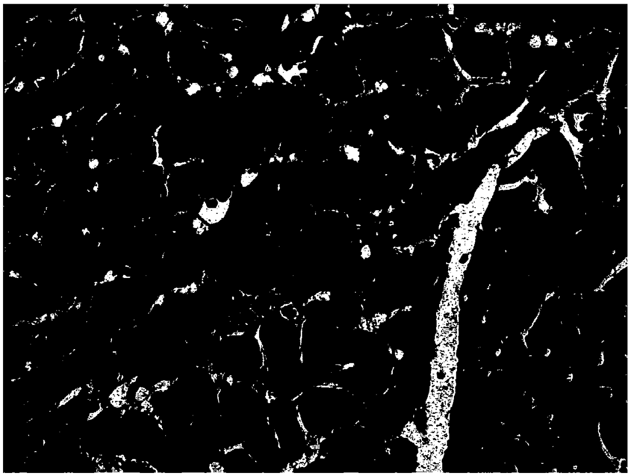 Construction method of diabetic cardiomyopathy animal model