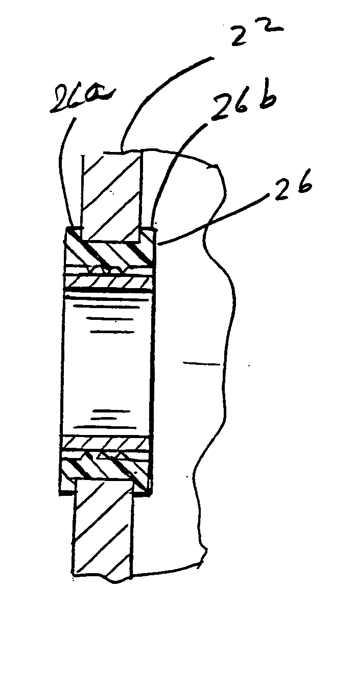 Surface mount ring assembly for loudspeaker