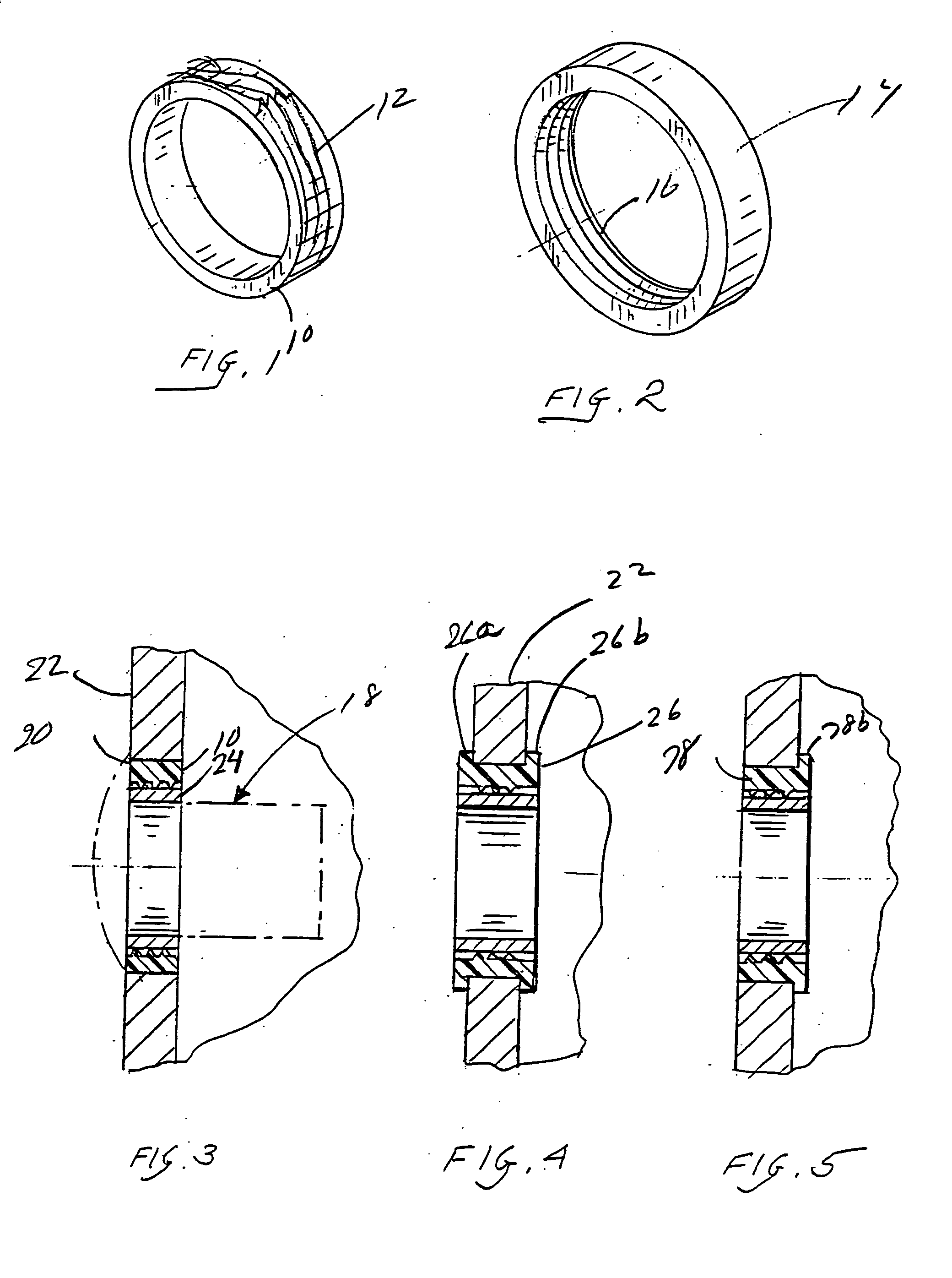 Surface mount ring assembly for loudspeaker