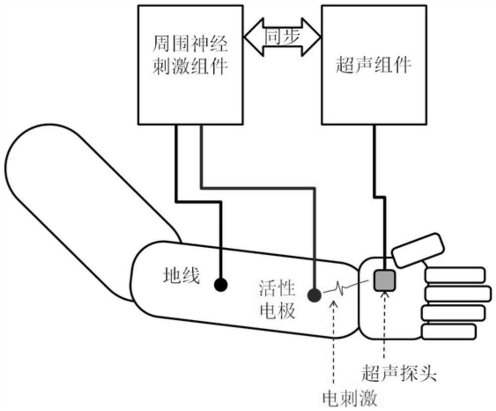 Device and method for detecting motor nerve feedback based on ultrasonic component and peripheral nerve stimulator