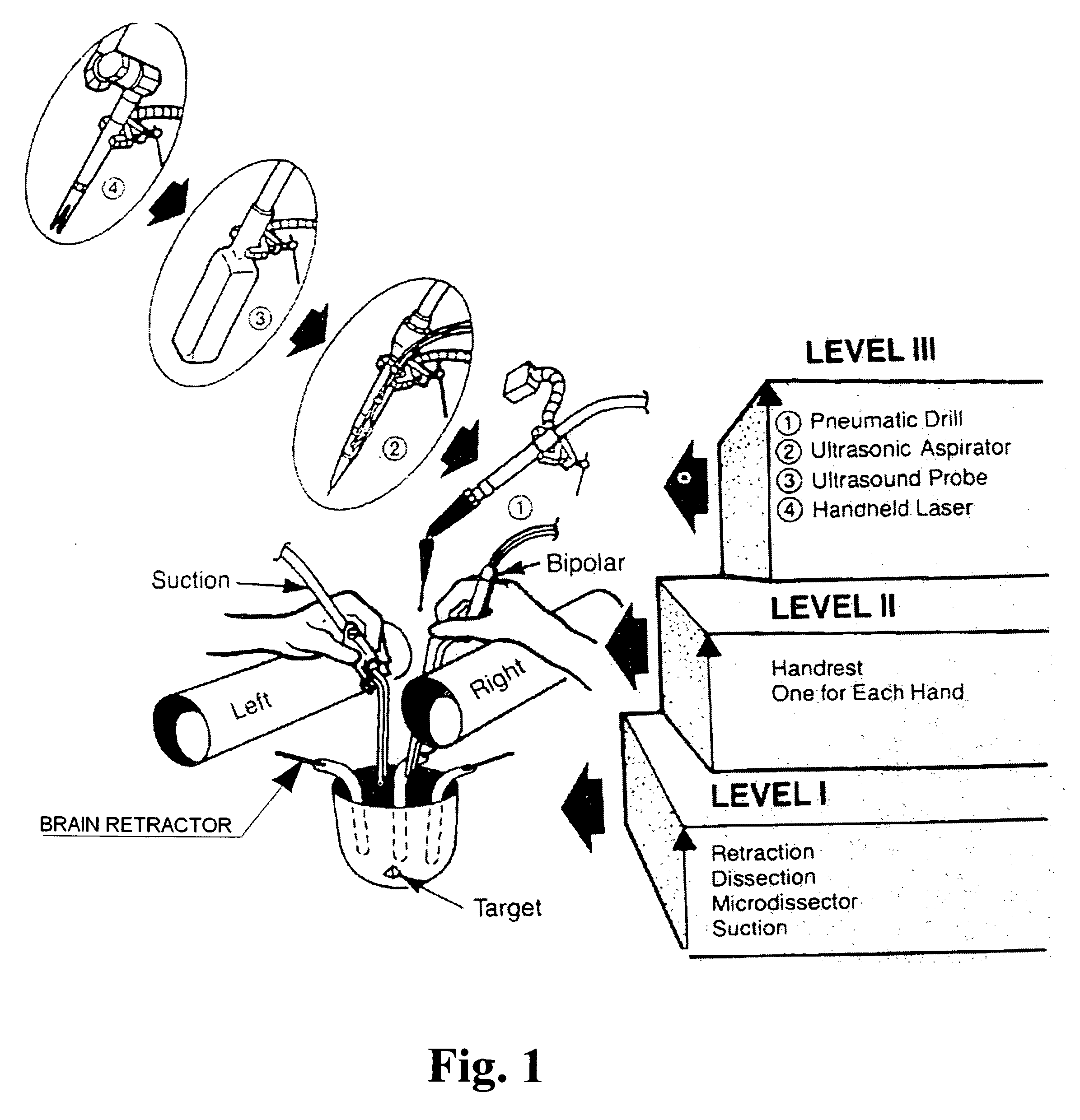 Peak contact pressure sensor system (PCPSS) and smart brain retractor system (SBRS)