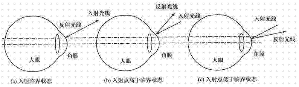 Method for eliminating stray light of fundus camera