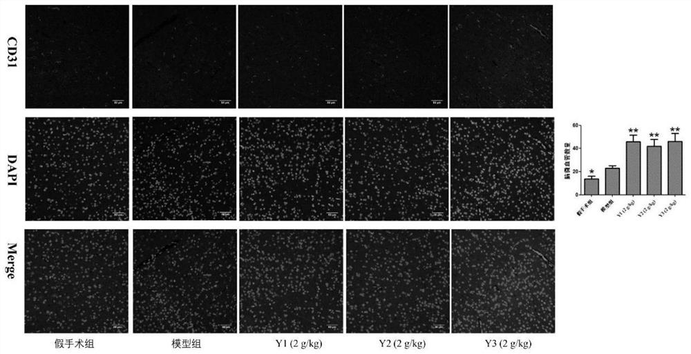 Pharmaceutical composition for improving cerebral ischemia and application thereof