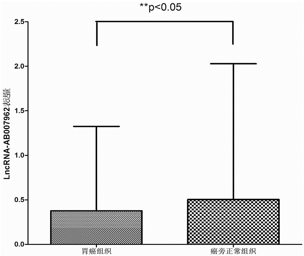 Detection and application of novel molecular marker IncRNA (long non-coding RNA) AB007962 for gastric cancer prognosis