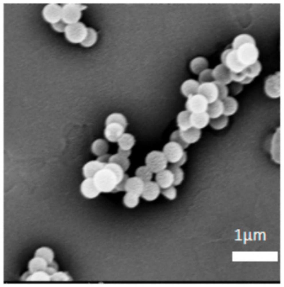 A kind of preparation method of thermosensitive hydrogel and thermosensitive hydrogel