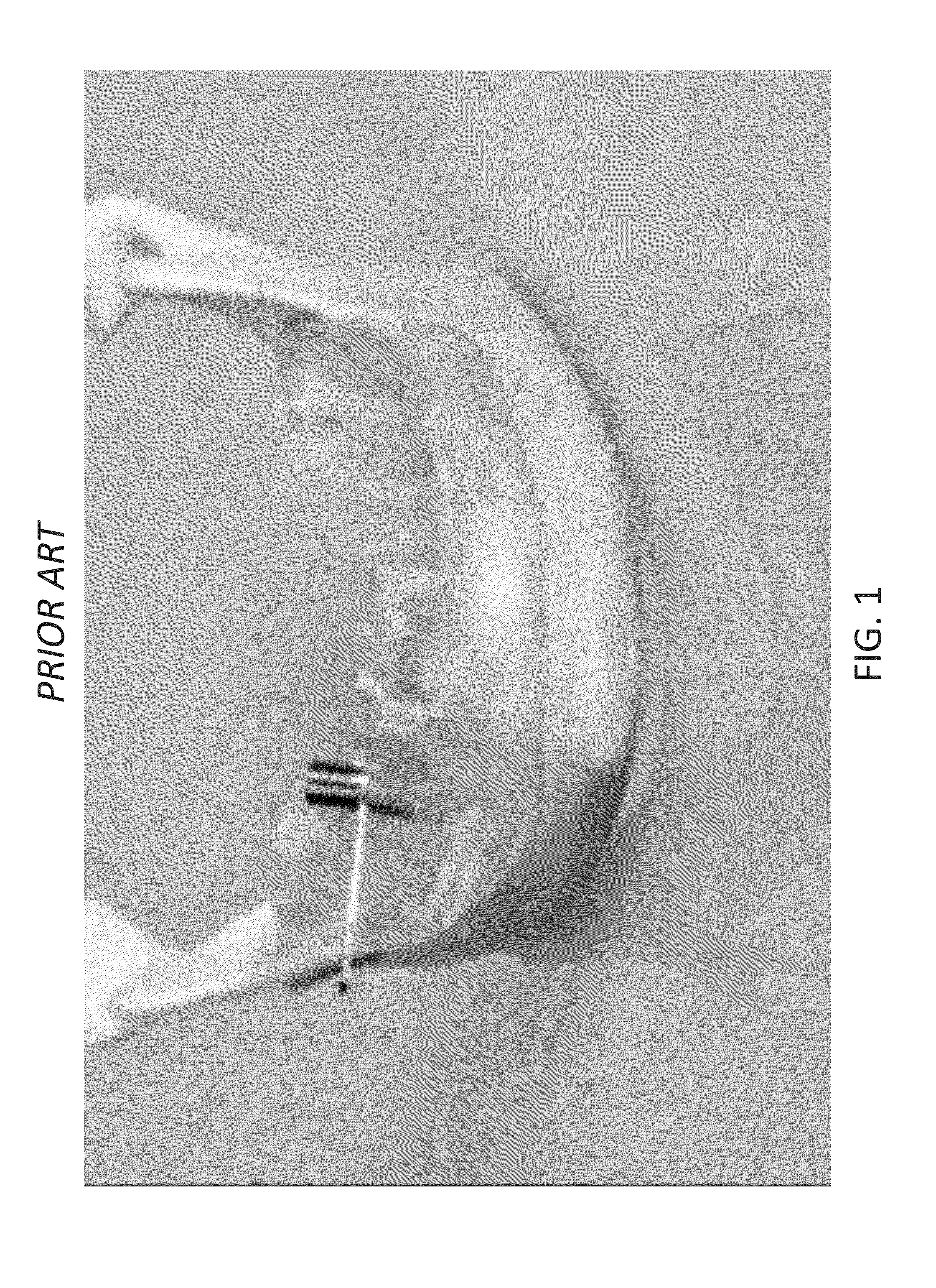 Dental device comprising surgical template and false teeth set and related methods