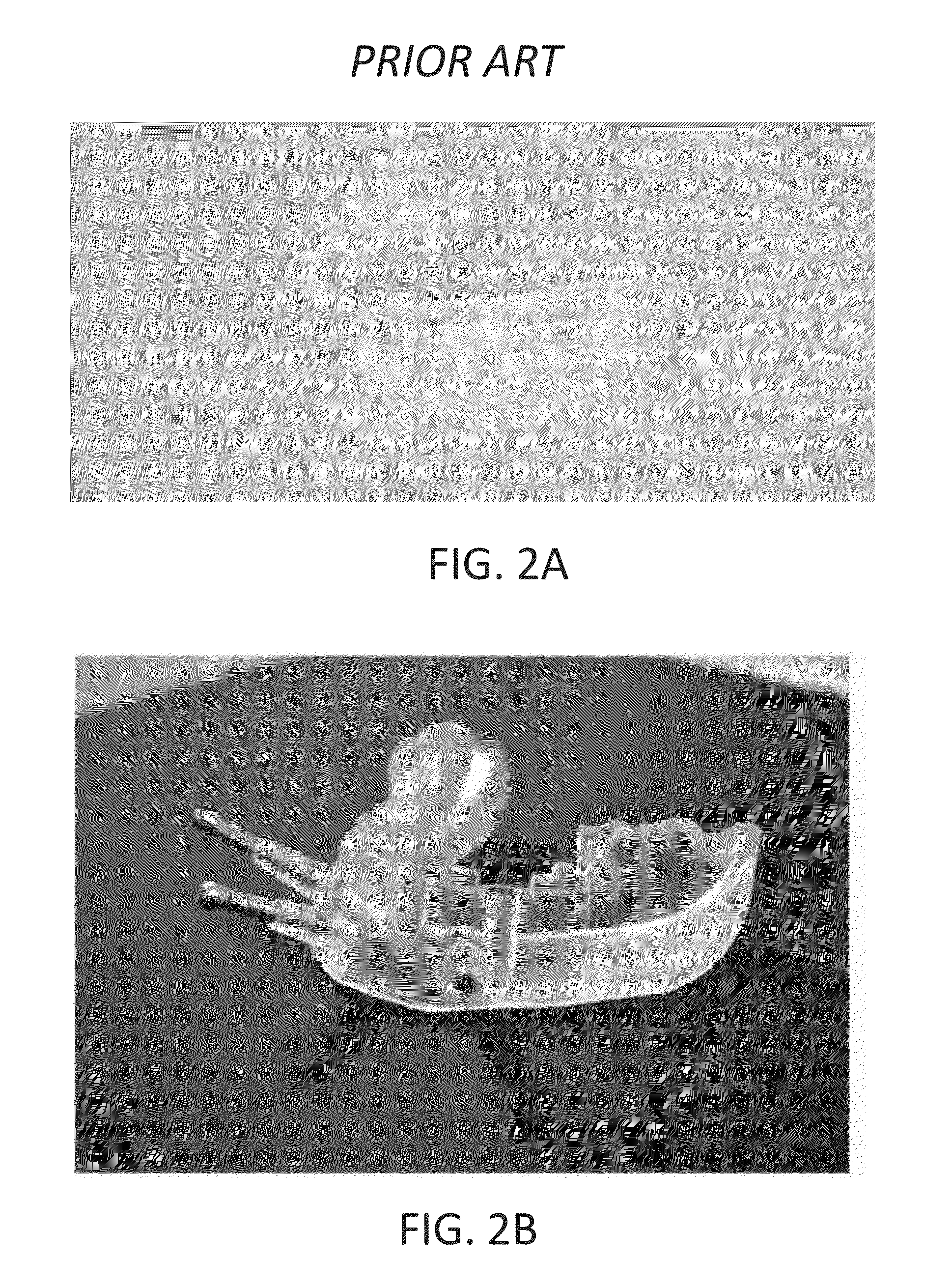 Dental device comprising surgical template and false teeth set and related methods