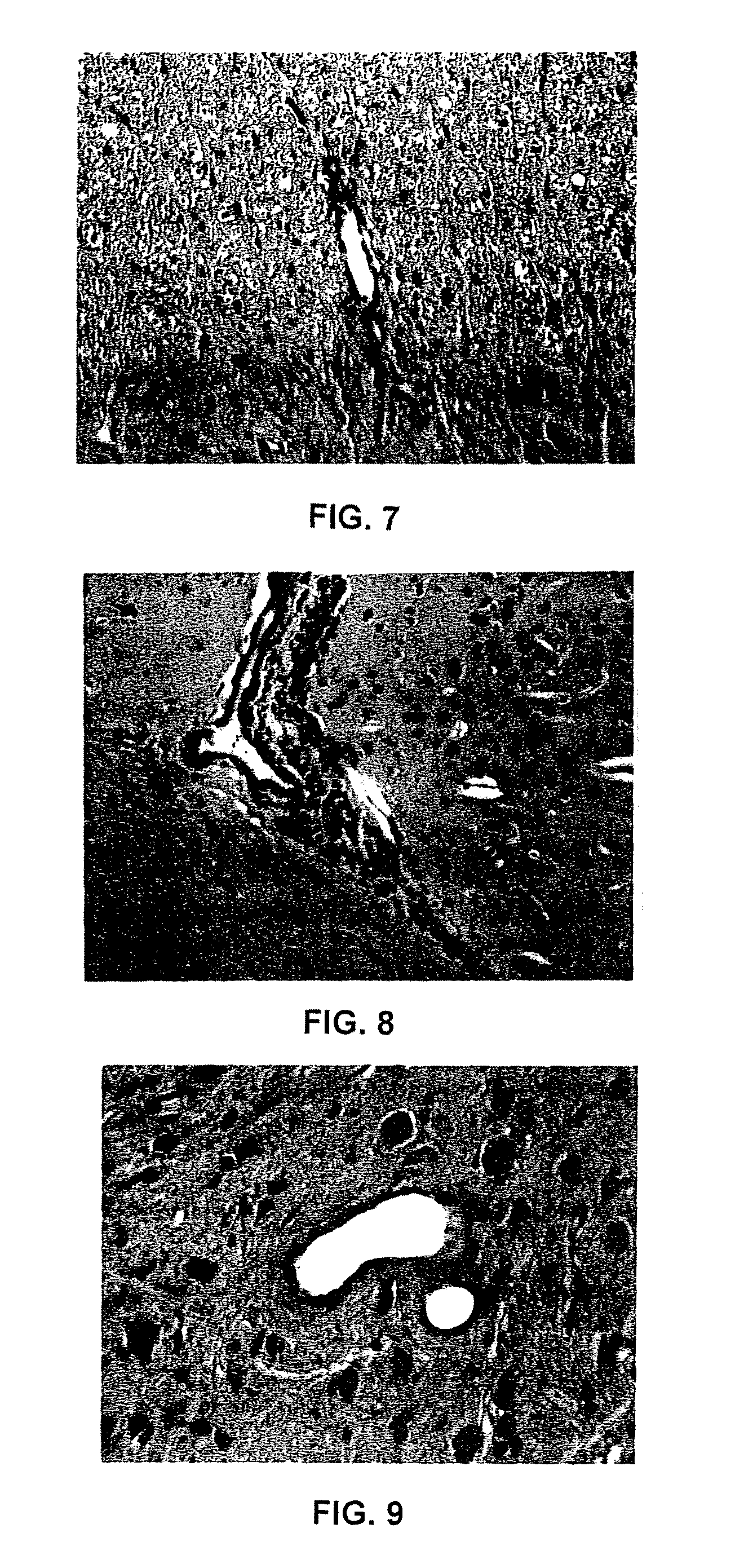 Modified anticholinergic neurotoxins as modulators of the autoimmune reaction