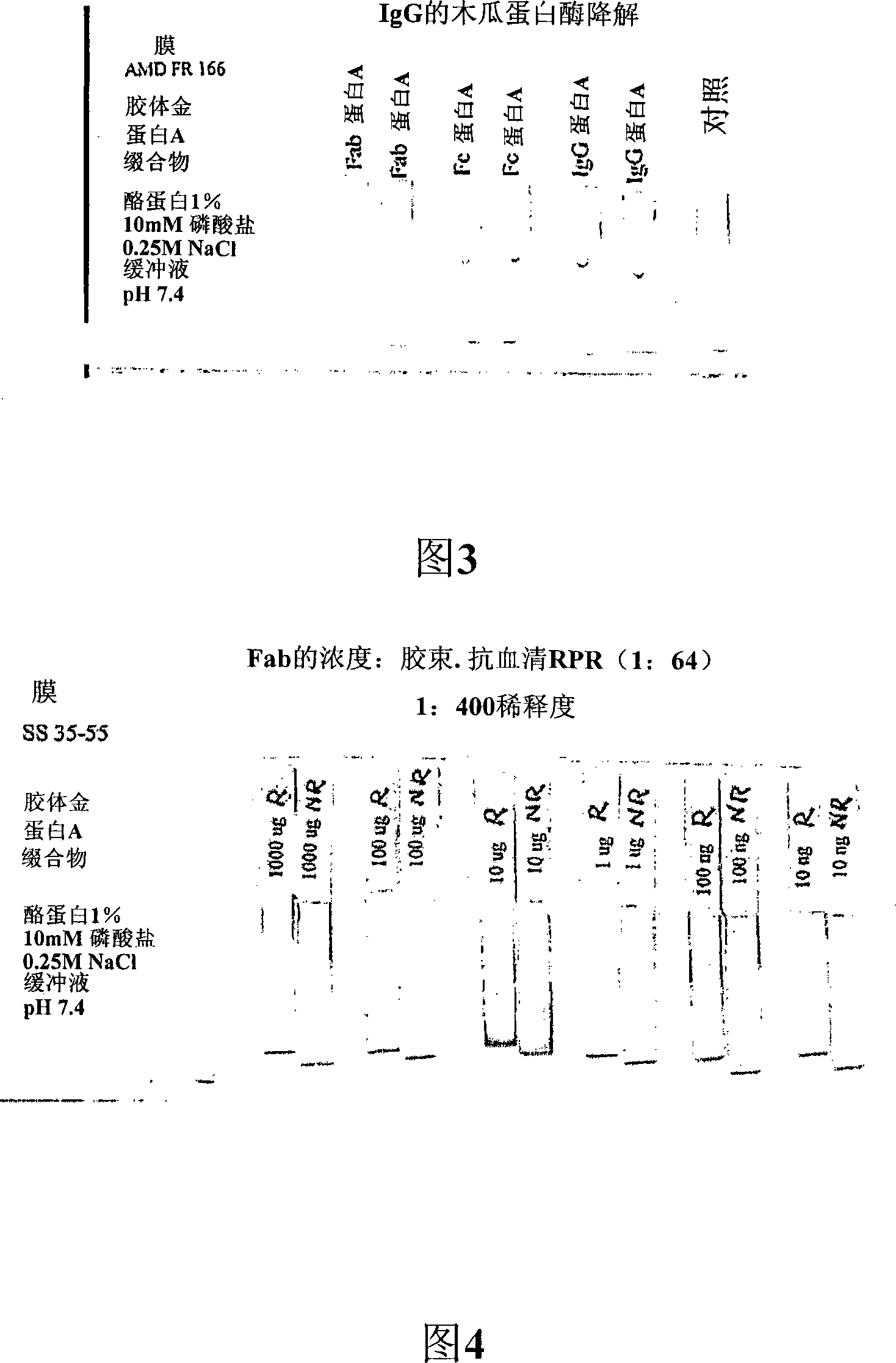 Methods, immunoassays and devices for detection of anti-lipoidal antibodies