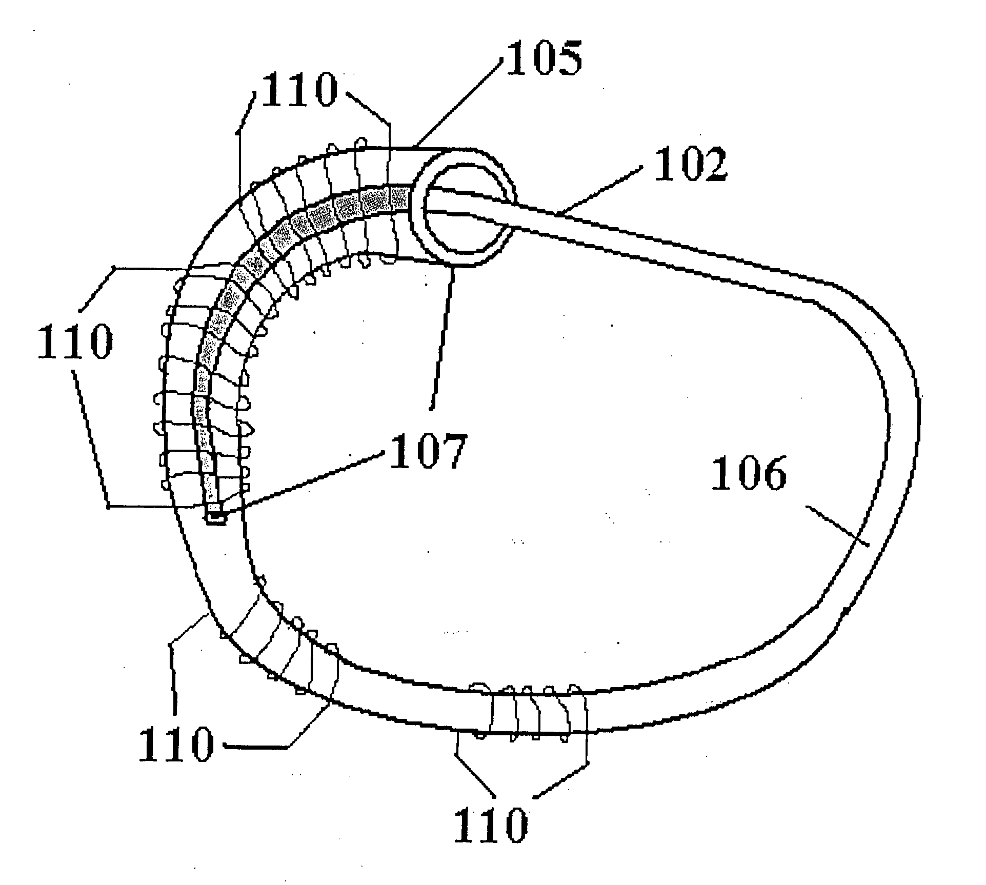 Cardiac implant device