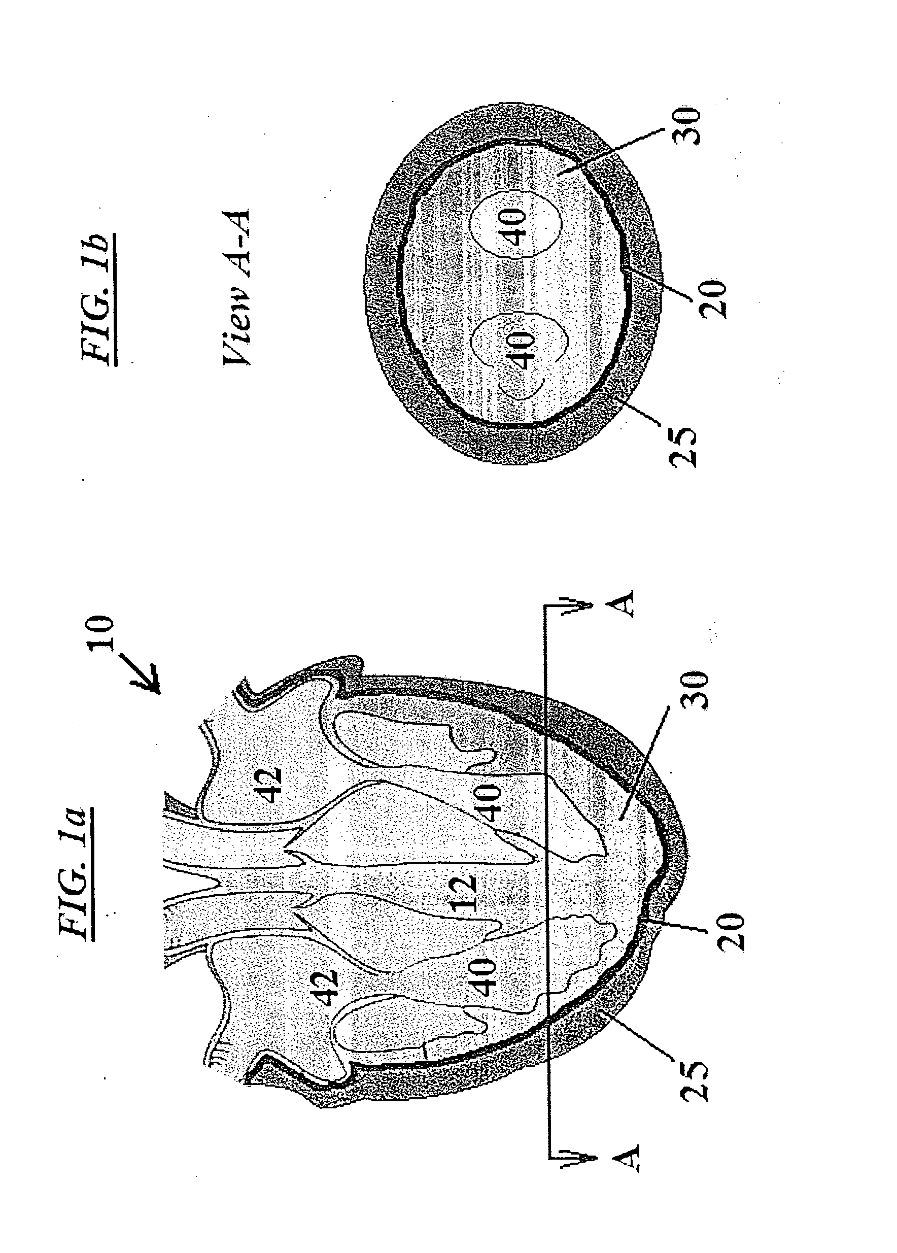 Cardiac implant device