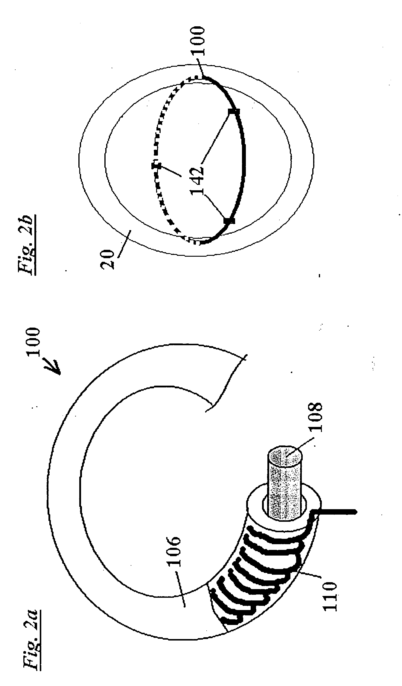 Cardiac implant device