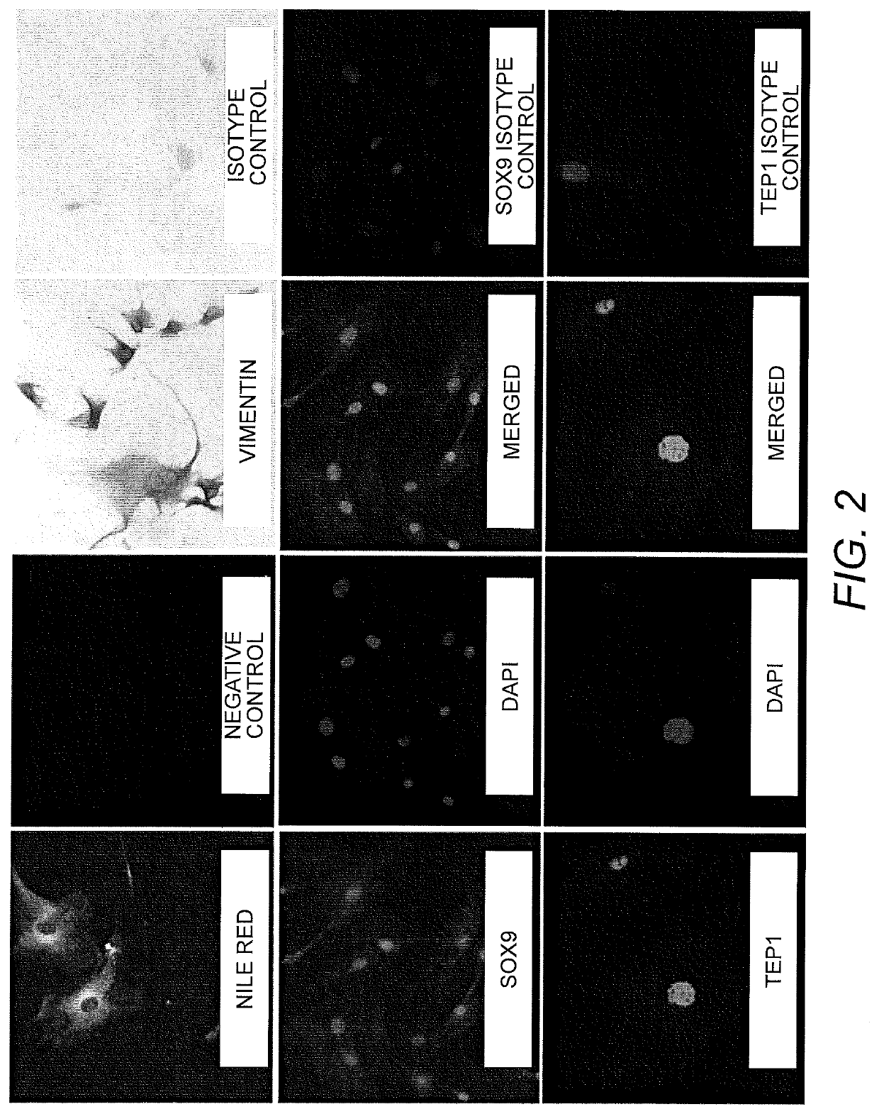 Method of producing in vitro testicular constructs and uses thereof