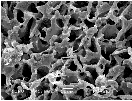 Preparation method of hyaluronic acid-chitosan degradable dressing