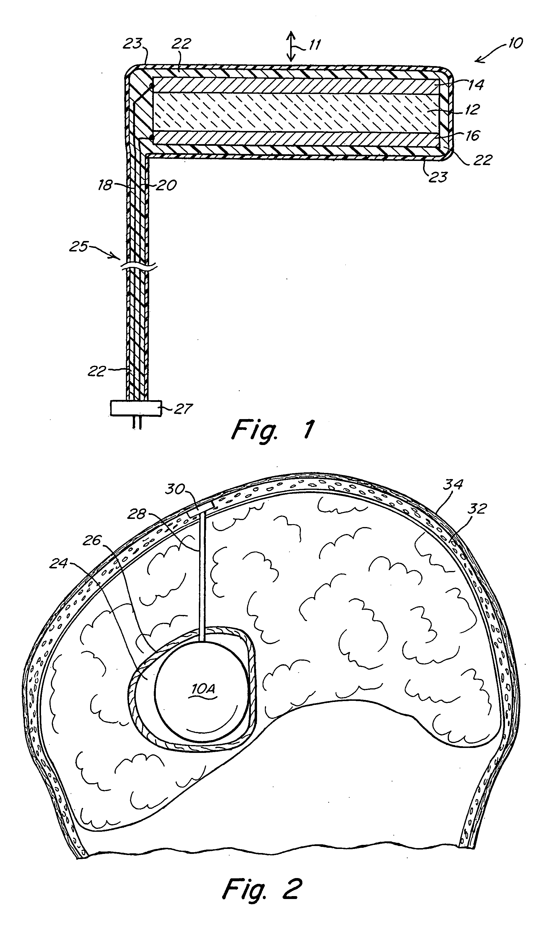 Method and apparatus for ultrasonically increasing the transportation of therapeutic substances through tissue