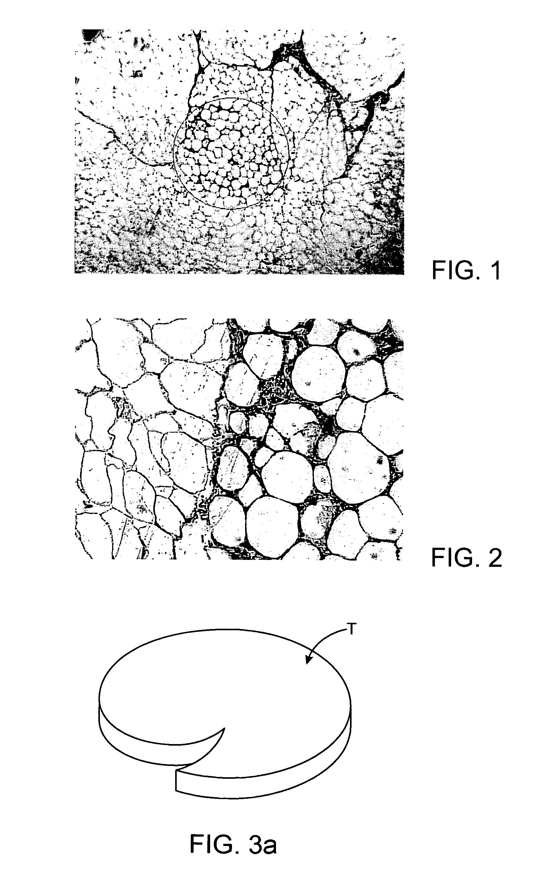 Medical ultrasound transducer having non-ideal focal region