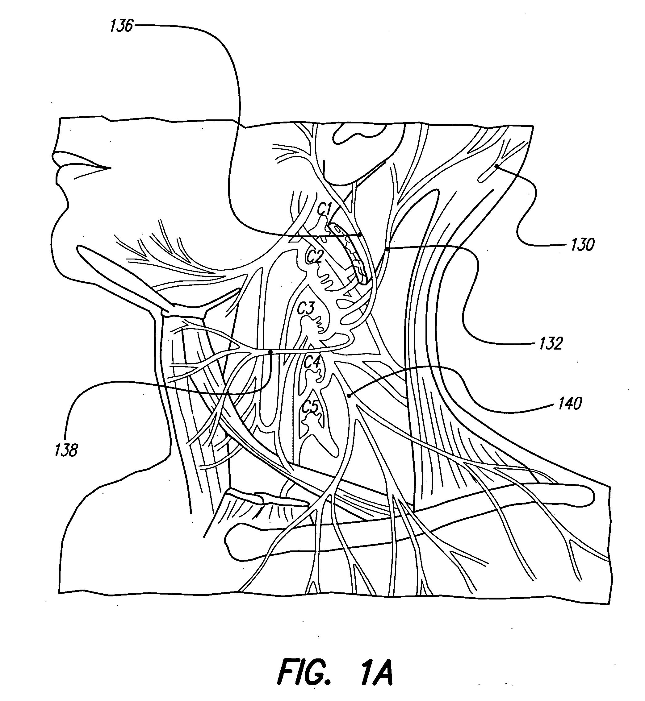 Skull-mounted electrical stimulation system