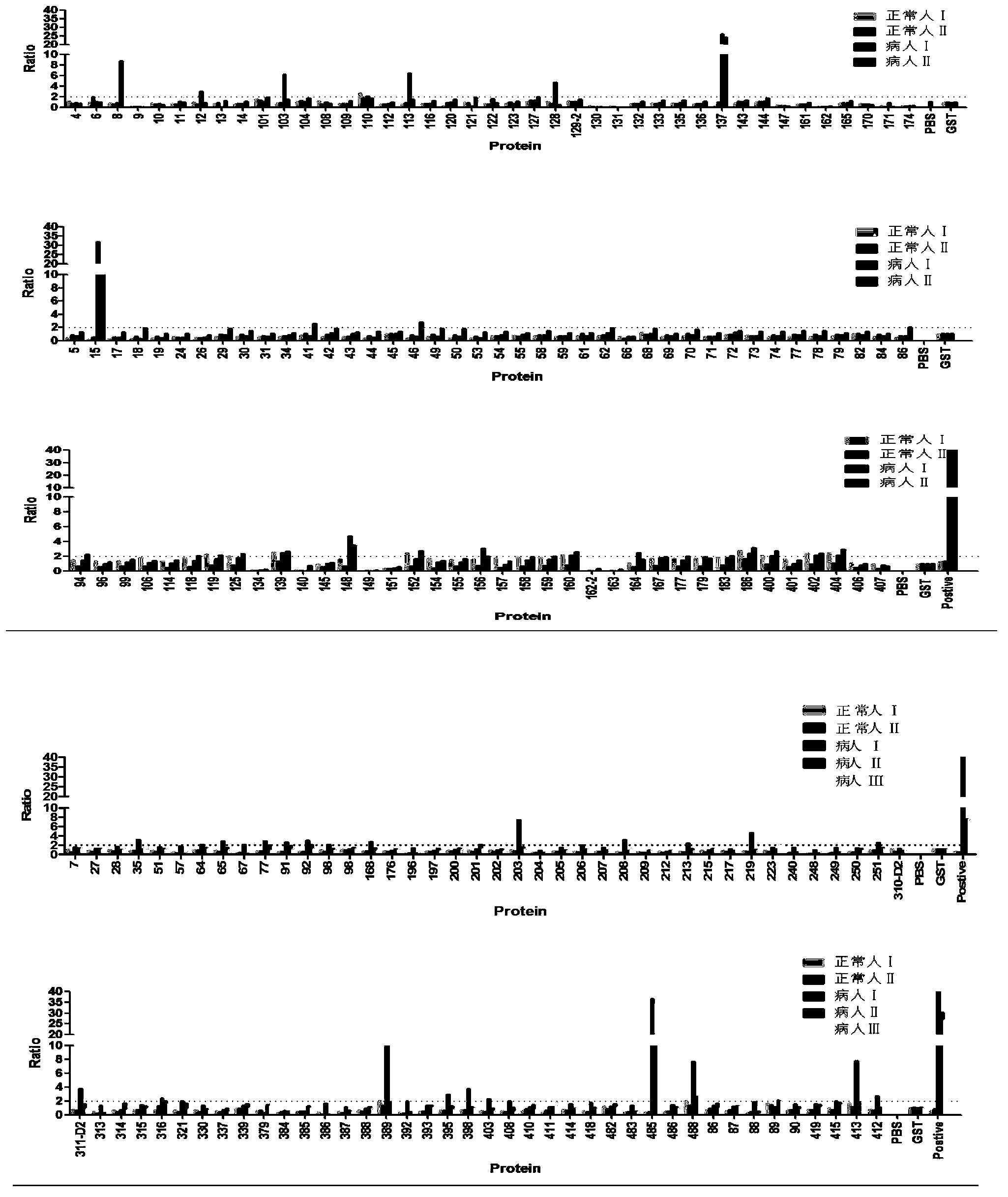 High throughput screening of tubercle bacillus important antigens, and application of tubercle bacillus important antigens in tuberculosis diagnosis