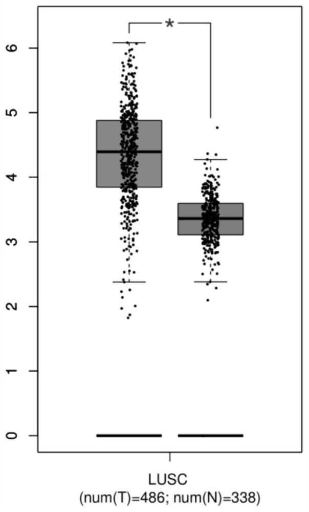 Human GPD2 gene inhibitor and its application