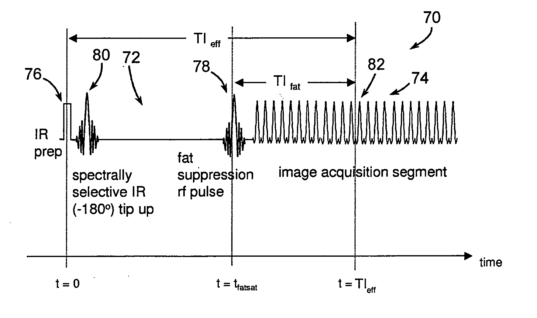 Method and system of MR imaging with simultaneous fat suppression and T1 inversion recovery contrast