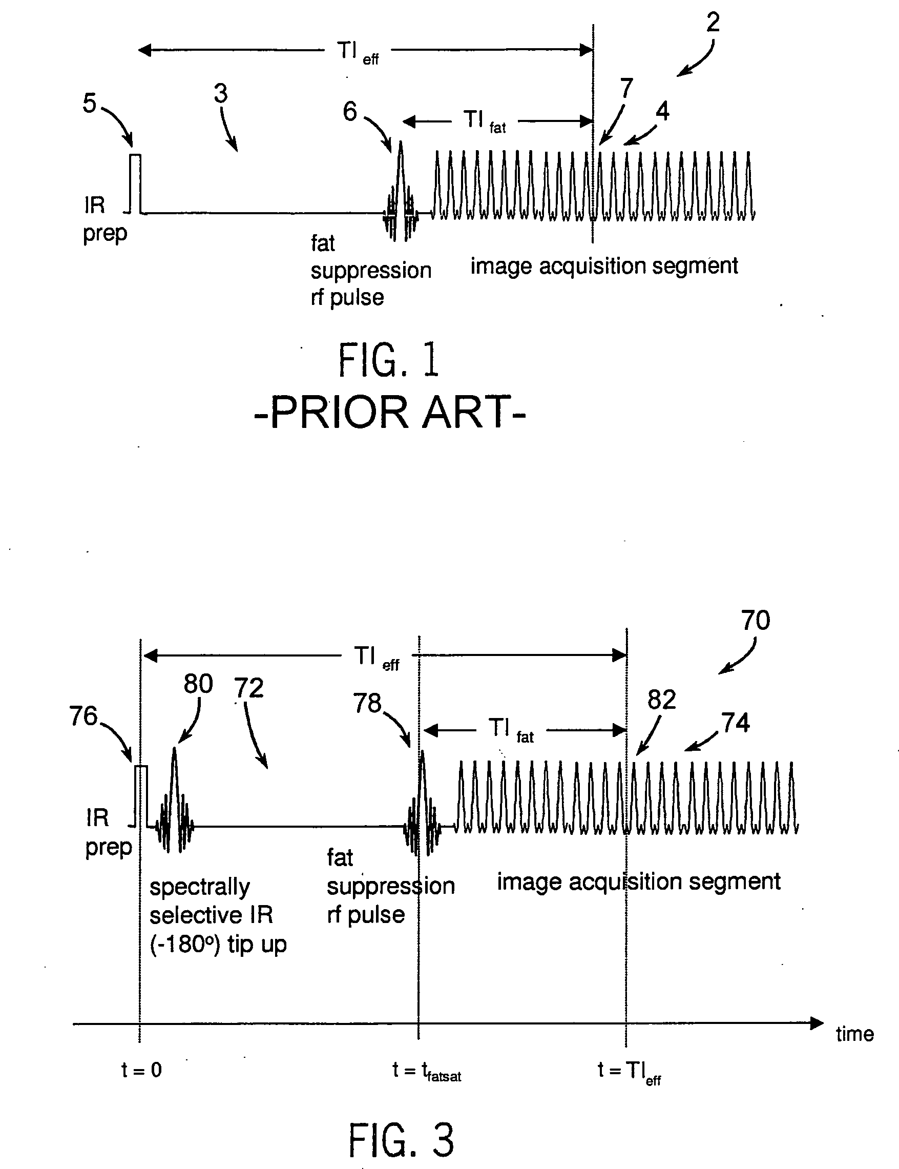 Method and system of MR imaging with simultaneous fat suppression and T1 inversion recovery contrast