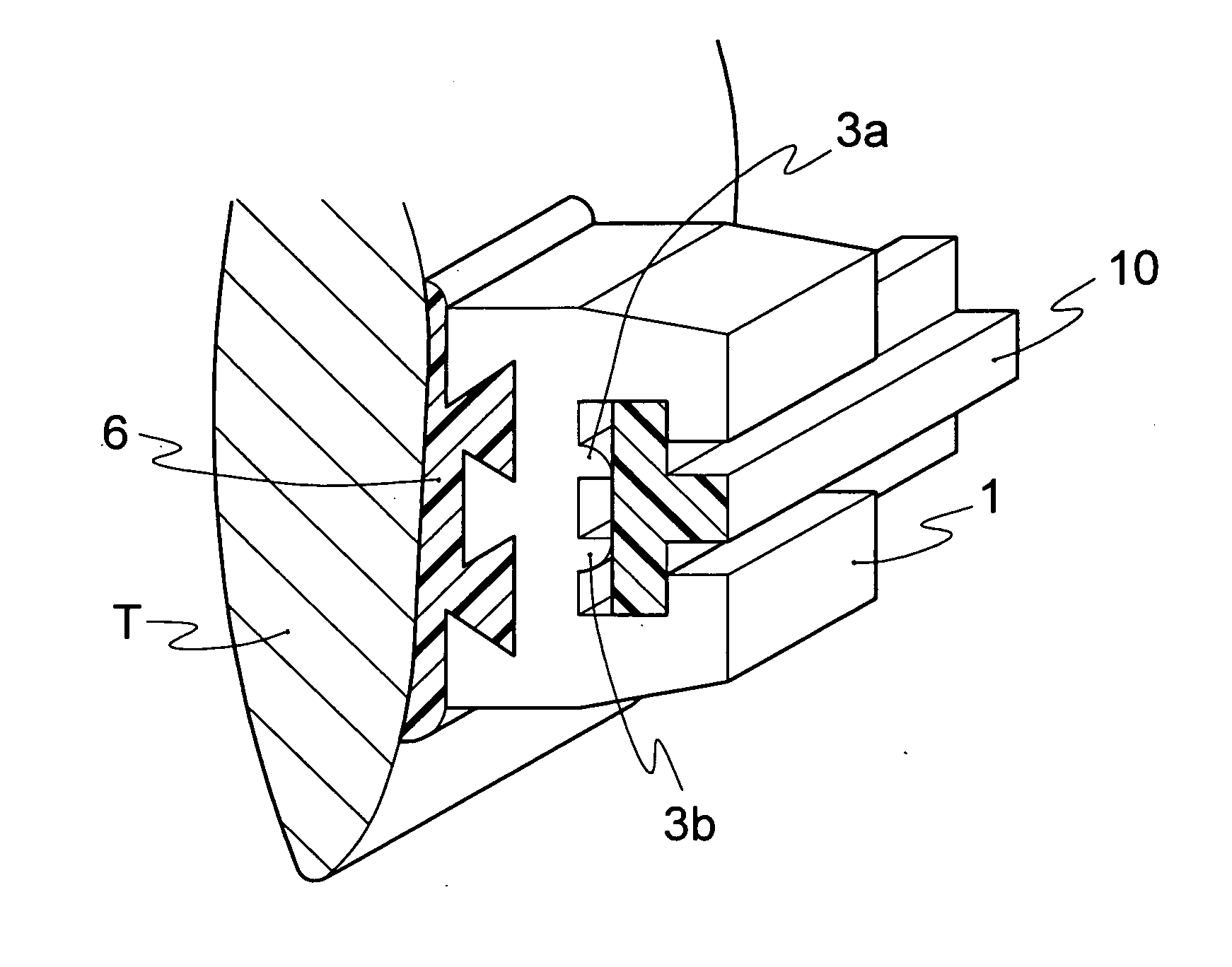 Orthodontic bracket and arch wire