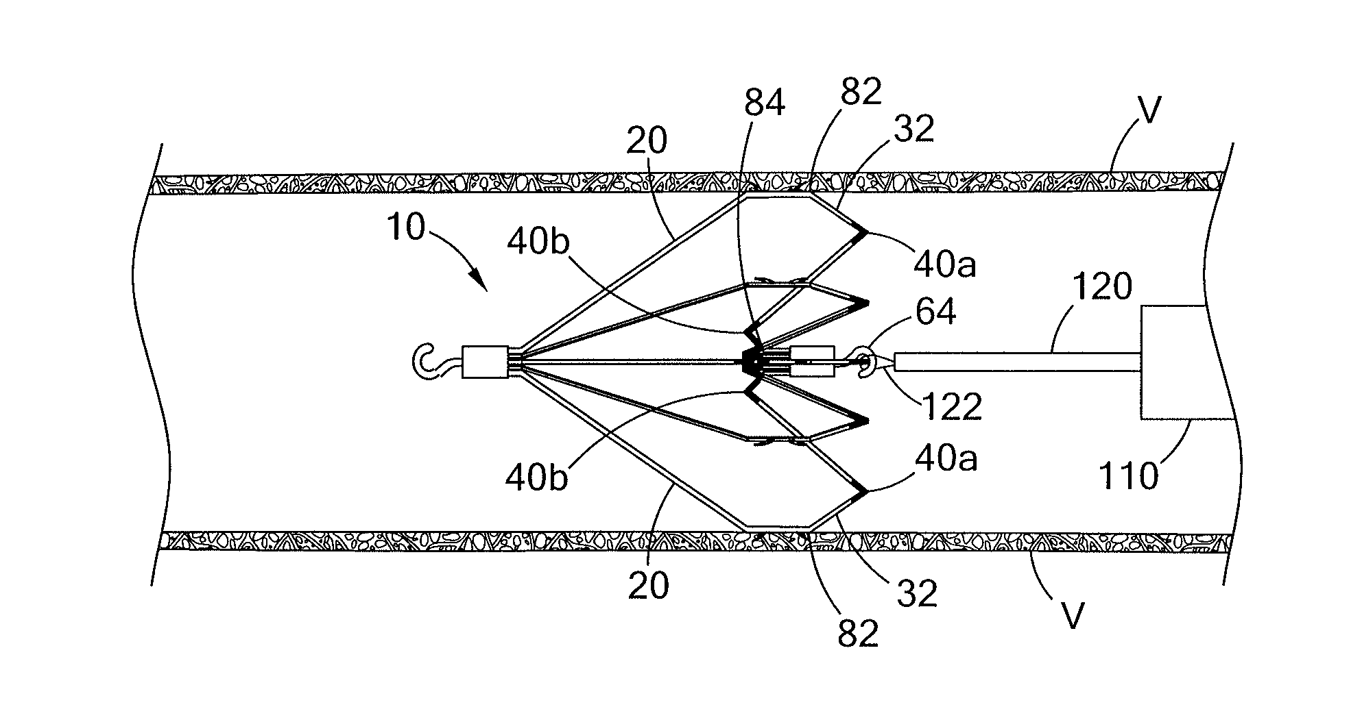 Conical vena cava filter with jugular or femoral retrieval