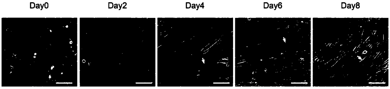 Human myoblast exosome preparation method, product and application thereof