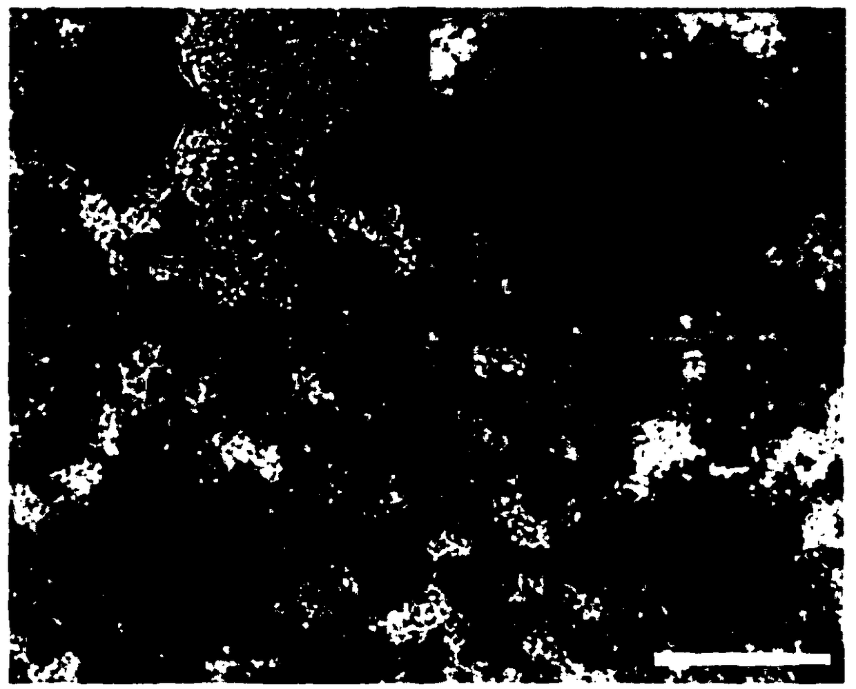 Human myoblast exosome preparation method, product and application thereof