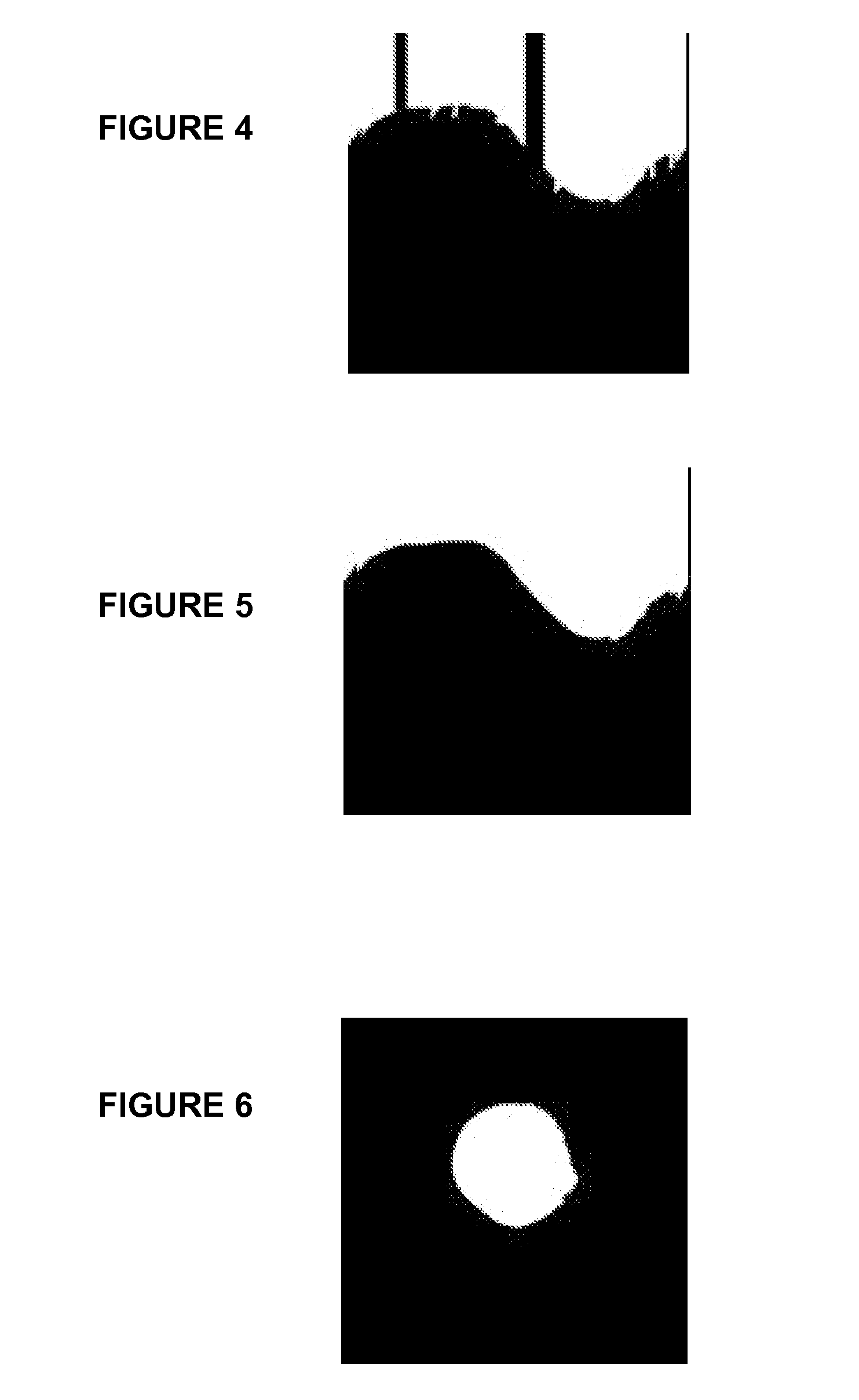 Method and system for stabilizing a series of intravascular ultrasound images and extracting vessel lumen from the images